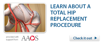 Total Hip Replacement Procedure