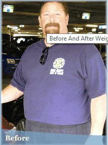 Craig before weight loss