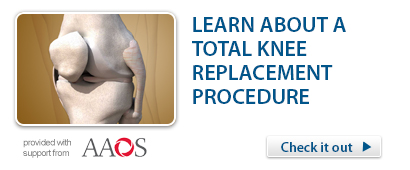 Total Knee Replacement Procedure